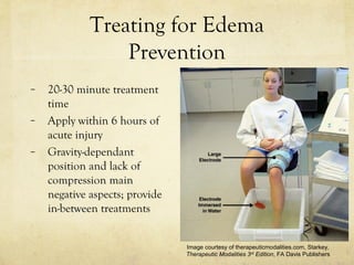Treating for Edema
Prevention
– 20-30 minute treatment
time
– Apply within 6 hours of
acute injury
– Gravity-dependant
position and lack of
compression main
negative aspects; provide
in-between treatments
Image courtesy of therapeuticmodalities.com, Starkey,
Therapeutic Modalities 3rd
Edition, FA Davis Publishers
 