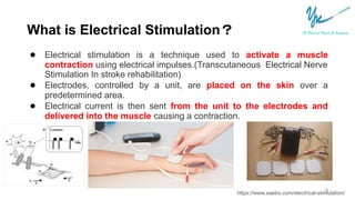 https://image.slidesharecdn.com/electricalstimulationinhandrecoveryv2-211121130504/85/how-to-use-electrical-stimulation-for-faster-hand-recovery-after-stroke-by-msyvonne-3-320.jpg?cb=1668282689