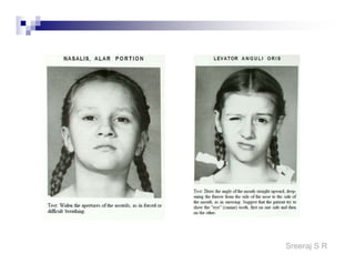 Sreeraj S R
PRINCIPLES OF APPLICATION
LOW FREQUENCY
 