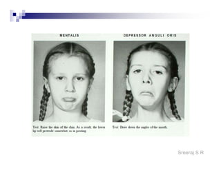 Sreeraj S R
Tray Preparation
Skin Resistance Lowering Tray
Pillows
Cotton
Soap
Towel
Mackintosh
Kidney Tray
Petroleum jelly or Vaseline
U – pin (sharp & blunt)
Clips
Bowel of water
 