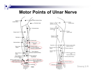 Sreeraj S R
Motor Points of Ulnar Nerve
3 & 4
 