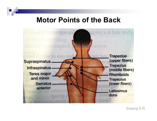 Motor Points For Electrical Stimulation Chart