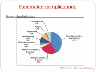 Pacemaker complications
Device related infection :




                             2007;49;1851-1859 J. Am. Coll. Cardiol.
 