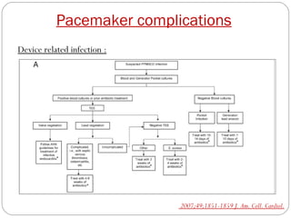 Pacemaker complications
Device related infection :




                             2007;49;1851-1859 J. Am. Coll. Cardiol.
 