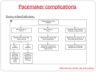 Pacemaker complications
Device related infection :




                             2007;49;1851-1859 J. Am. Coll. Cardiol.
 