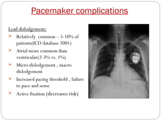 Pacemaker complications
Lead dislodgement:
 Relatively common – 5-10% of
    patients(ICD database 2001)
 Atrial more common than
    ventricular(2-3% vs. 1%)
 Micro dislodgement , macro
    dislodgement
 Increased pacing threshold , failure
    to pace and sense
 Active fixation (decreases risk)
 