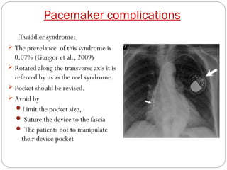 Pacemaker complications
    Twiddler syndrome:
 The prevelance of this syndrome is
  0.07% (Gungor et al., 2009)
 Rotated along the transverse axis it is
  referred by us as the reel syndrome.
 Pocket should be revised.
 Avoid by
  Limit the pocket size,
   Suture the device to the fascia
   The patients not to manipulate
     their device pocket
 