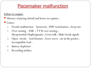 Pacemaker malfunction
Failure to output:
 Absence of pacing stimuli and hence no capture .
 Causes
   1. Pseudo malfunction - hysteresis , PMT termination , sleep rate
   2. Over sensing - EMI ; T P R over sensing ;
       Myopotential/diaphragmatic ; Cross talk ; Make break signals
   3. Open circuit - lead fracture , loose screw , air in the pocket ,
       incompatible lead .
   4. Battery depletion
   5. Recording artifact.
 