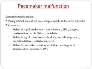 Pacemaker malfunction
Pacemaker undersensing :
 Pacing artifact present but no sensing(sensed beat doesn’t reset cycle)
 Causes are
  1. Defect in signal production – scar /fibrosis , BBB , ectopic ,
      cardioversion , defibrillation , metabolic.
  2. Defect in signal transmission – lead fracture /dislodgement ,
      insulation failure , partial open circuit.
  3. Defect in pacemaker – battery depletion , sensing circuit
      abnormalities , committed DVI.
 