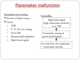 Pacemaker malfunction
Pacemaker over sensing :
                                Cross talk :
 Present as failure to pace
                                       High atrial output
 Causes
                                   High ventricular sensitivity
  1. EMI                                   Low VBP
  2. T , P , R over sensing .
  3. Cross talk                   Ventricular sensing of
  4. Myopotential (unipolar)      paced atrial impulse
  5. Make break signals
                                Pts with Poor AV conduction
                                – Ventricular Asystole
 