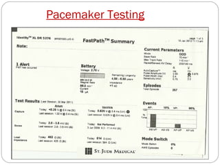 Pacemaker Testing
 