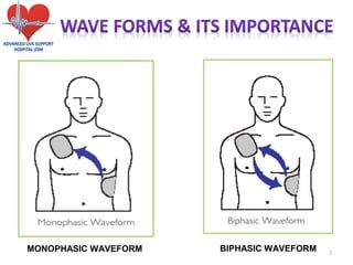 17
MONOPHASIC WAVEFORM BIPHASIC WAVEFORM
 