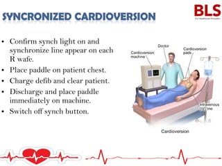 • Confirm synch light on and
synchronize line appear on each
R wafe.
• Place paddle on patient chest.
• Charge defib and clear patient.
• Discharge and place paddle
immediately on machine.
• Switch off synch button.
 