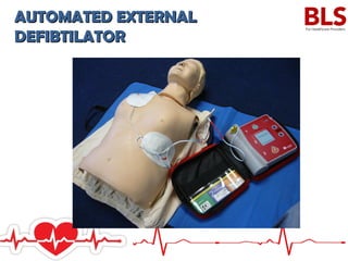 AUTOMATED EXTERNALAUTOMATED EXTERNAL
DEFIBTILATORDEFIBTILATOR
 