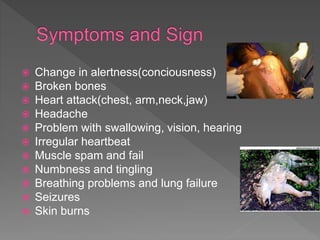 Change in alertness(conciousness)
 Broken bones
 Heart attack(chest, arm,neck,jaw)
 Headache
 Problem with swallowing, vision, hearing
 Irregular heartbeat
 Muscle spam and fail
 Numbness and tingling
 Breathing problems and lung failure
 Seizures
 Skin burns
 