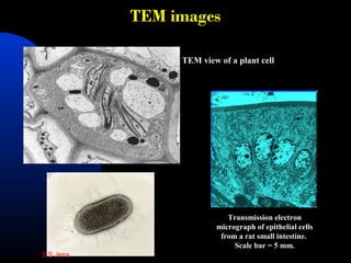 TEM images
Transmission electron
micrograph of epithelial cells
from a rat small intestine.
Scale bar = 5 mm.
TEM view of a plant cell
S S Jena
 