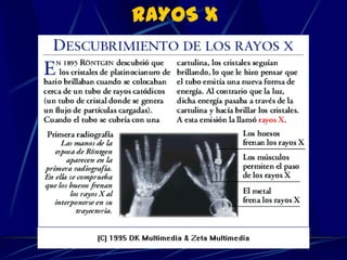 RAYOS X
 