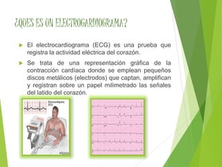 ¿QUES ES UN ELECTROGARDIOGRAMA? 
 El electrocardiograma (ECG) es una prueba que 
registra la actividad eléctrica del corazón. 
 Se trata de una representación gráfica de la 
contracción cardíaca donde se emplean pequeños 
discos metálicos (electrodos) que captan, amplifican 
y registran sobre un papel milimetrado las señales 
del latido del corazón. 
 