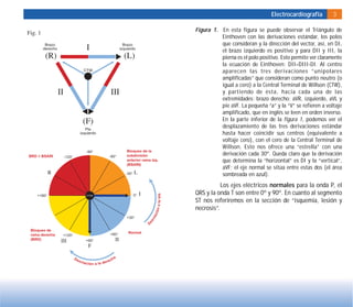 Electrocardiografía 3
Figura 1. En esta figura se puede observar el Triángulo de
Einthoven con las derivaciones estándar, los polos
que consideran y la dirección del vector, así, en DI,
el brazo izquierdo es positivo y para DII y III, la
pierna es el polo positivo. Esto permite ver claramente
la ecuación de Einthoven: DII=DIII-DI. Al centro
aparecen las tres derivaciones “unipolares
amplificadas” que consideran como punto neutro (o
igual a cero) a la Central Terminal de Willson (CTW),
y partiendo de ésta, hacia cada una de las
extremidades: brazo derecho: aVR, izquierdo, aVL y
pie aVF. La pequeña “a” y la “V” se refieren a voltaje
amplificado, que en inglés se leen en orden inverso.
En la parte inferior de la figura 1, podemos ver el
desplazamiento de las tres derivaciones estándar
hasta hacer coincidir sus centros (equivalente a
voltaje cero), con el cero de la Central Terminal de
Willson. Esto nos ofrece una “estrella” con una
derivación cada 30º. Queda claro que la derivación
que determina la “horizontal” es DI y la “vertical”,
aVF; el eje normal se sitúa entre estas dos (el área
sombreada en azul).
Los ejes eléctricos normales para la onda P, el
QRS y la onda T son entre 0º y 90º. En cuanto al segmento
ST nos referiremos en la sección de “isquemia, lesión y
necrosis”.
 
