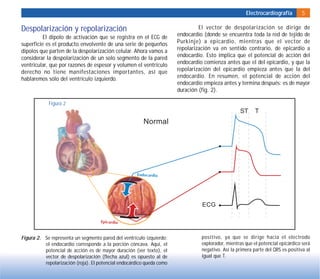 Electrocardiografía 5
Despolarización y repolarización
El dipolo de activación que se registra en el ECG de
superficie es el producto envolvente de una serie de pequeños
dipolos que parten de la despolarización celular. Ahora vamos a
considerar la despolarización de un solo segmento de la pared
ventricular, que por razones de espesor y volumen el ventrículo
derecho no tiene manifestaciones importantes, así que
hablaremos sólo del ventrículo izquierdo.
El vector de despolarización se dirige de
endocardio (donde se encuentra toda la red de tejido de
Purkinje) a epicardio, mientras que el vector de
repolarización va en sentido contrario, de epicardio a
endocardio. Esto implica que el potencial de acción del
endocardio comienza antes que el del epicardio, y que la
repolarización del epicardio empieza antes que la del
endocardio. En resumen, el potencial de acción del
endocardio empieza antes y termina después: es de mayor
duración (fig. 2).
Figura 2
Figura 2. Se representa un segmento pared del ventrículo izquierdo;
el endocardio corresponde a la porción cóncava. Aquí, el
potencial de acción es de mayor duración (ver texto), el
vector de despolarización (flecha azul) es opuesto al de
repolarización (roja). El potencial endocárdico queda como
positivo, ya que se dirige hacia el electrodo
explorador, mientras que el potencial epicárdico será
negativo. Así la primera parte del QRS es positiva al
igual que T.
 