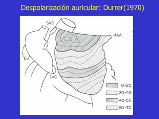 Despolarización auricular: Durrer(1970) 