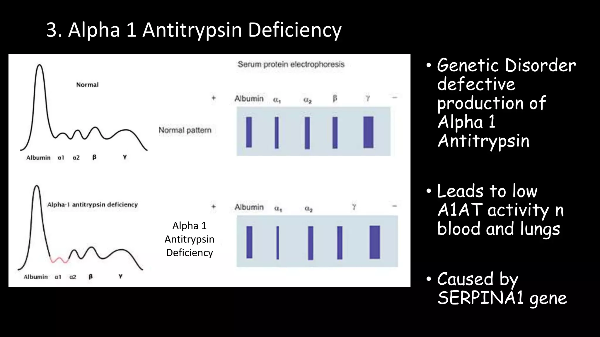 Interpretation of Serum Electrophoresis | PPTX