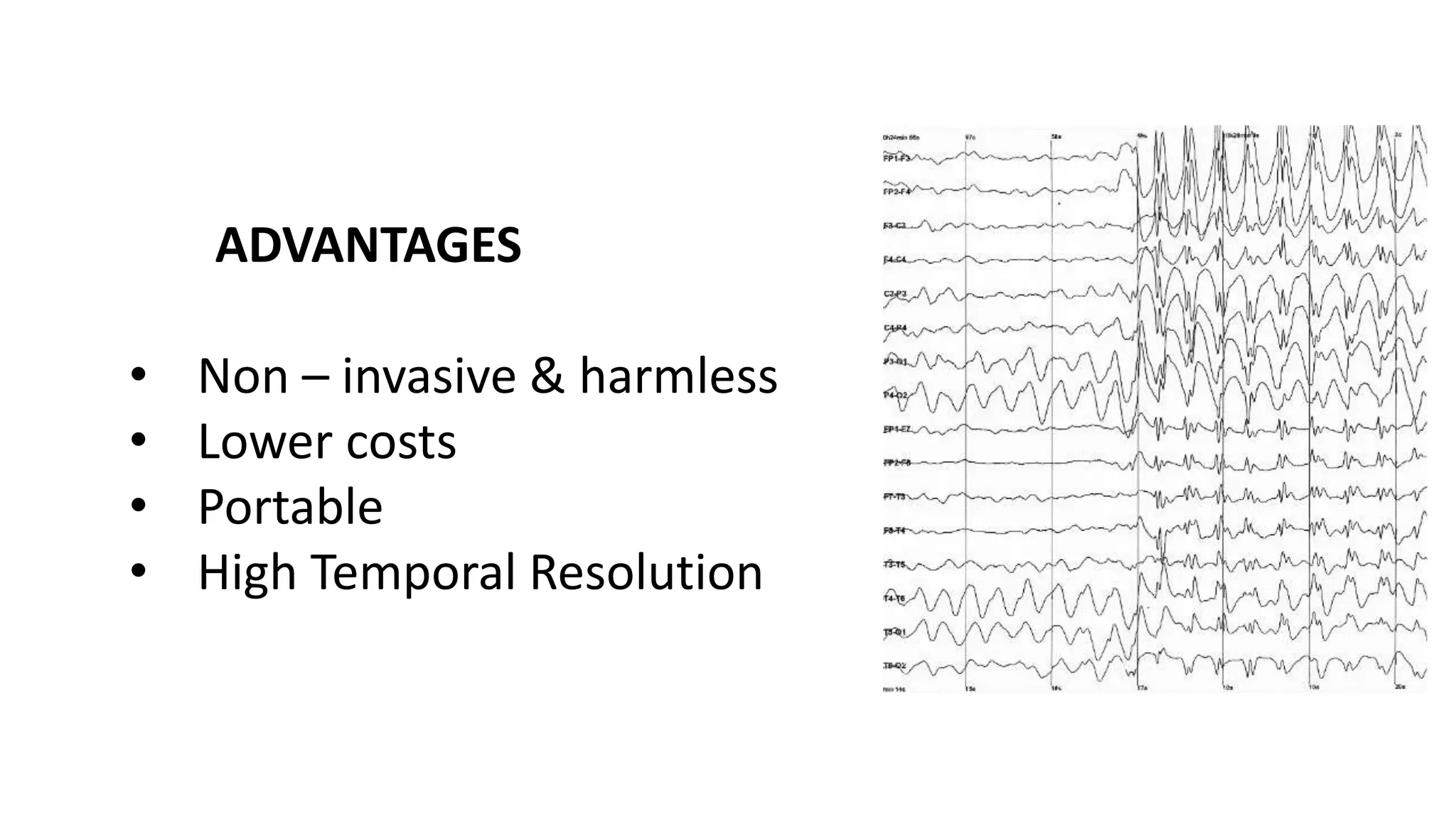 Electro-Encephalography.pptx