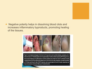  Negative polarity helps in dissolving blood clots and
increases inflammatory byproducts, promoting healing
of the tissues.
 