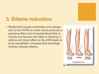 3. Edema reduction
 Rhythmical muscle contraction and release
due to the HVPS on motor nerve produces a
pumping effect and increased blood flow in
muscle and tissues and helps in draining in
edema and direct effect on the ANS leads to
local vasodilation, increase fluid exchange
thereby reduces edema .
 