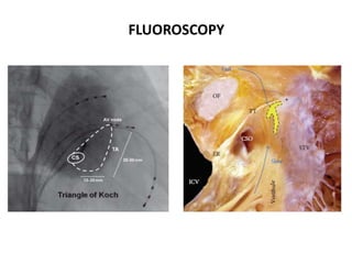 Electro anatomy.ppt