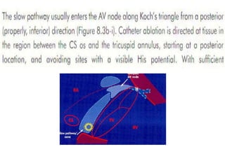 Electro anatomy.ppt