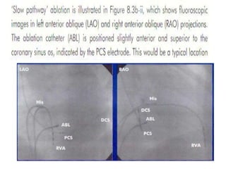 Electro anatomy.ppt