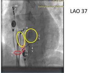 Electro anatomy.ppt