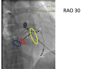 Electro anatomy.ppt