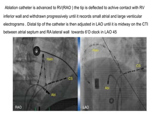 Rv Rao Electro anatomy.ppt