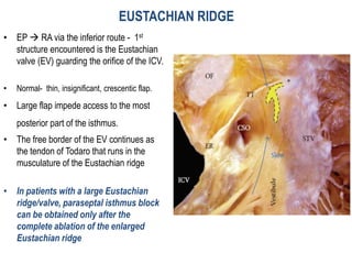 Electro anatomy.ppt