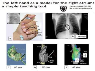 Electro anatomy.ppt