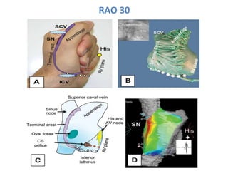 Electro anatomy.ppt