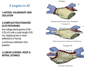 Electro anatomy.ppt