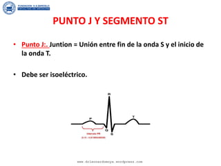 PUNTO J Y SEGMENTO ST
• Punto J:. Juntion = Unión entre fin de la onda S y el inicio de
la onda T.
• Debe ser isoeléctrico.
www.drleonardomoya.wordpress.com
 