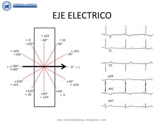 EJE ELECTRICO
www.drleonardomoya.wordpress.com
 
