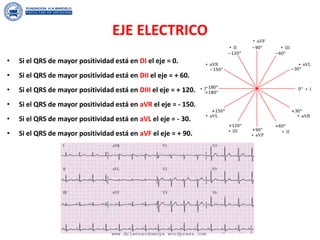 EJE ELECTRICO
• Si el QRS de mayor positividad está en DI el eje = 0.
• Si el QRS de mayor positividad está en DII el eje = + 60.
• Si el QRS de mayor positividad está en DIII el eje = + 120.
• Si el QRS de mayor positividad está en aVR el eje = - 150.
• Si el QRS de mayor positividad está en aVL el eje = - 30.
• Si el QRS de mayor positividad está en aVF el eje = + 90.
www.drleonardomoya.wordpress.com
 