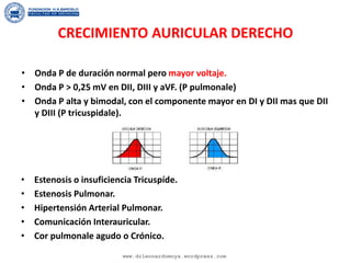 CRECIMIENTO AURICULAR DERECHO
• Estenosis o insuficiencia Tricuspíde.
• Estenosis Pulmonar.
• Hipertensión Arterial Pulmonar.
• Comunicación Interauricular.
• Cor pulmonale agudo o Crónico.
• Onda P de duración normal pero mayor voltaje.
• Onda P > 0,25 mV en DII, DIII y aVF. (P pulmonale)
• Onda P alta y bimodal, con el componente mayor en DI y DII mas que DII
y DIII (P tricuspidale).
www.drleonardomoya.wordpress.com
 