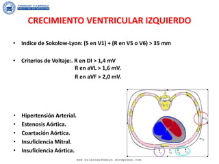 CRECIMIENTO VENTRICULAR IZQUIERDO
• Indice de Sokolow-Lyon: (S en V1) + (R en V5 o V6) > 35 mm
• Criterios de Voltaje:. R en DI > 1,4 mV
R en aVL > 1,6 mV.
R en aVF > 2,0 mV.
• Hipertensión Arterial.
• Estenosis Aórtica.
• Coartación Aórtica.
• Insuficiencia Mitral.
• Insuficiencia Aórtica.
www.drleonardomoya.wordpress.com
 