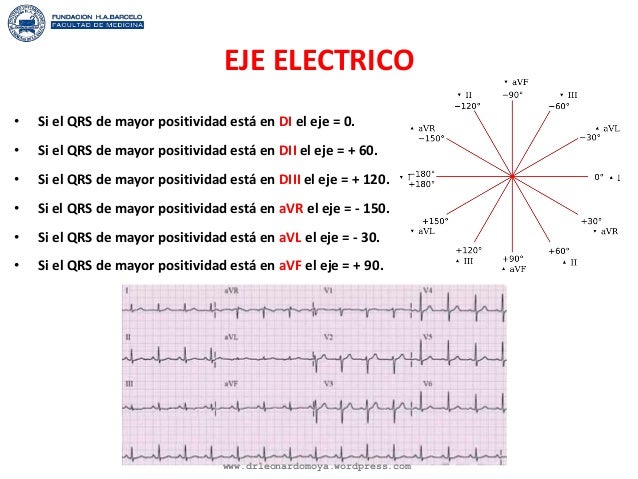 Electrocardiografía basica