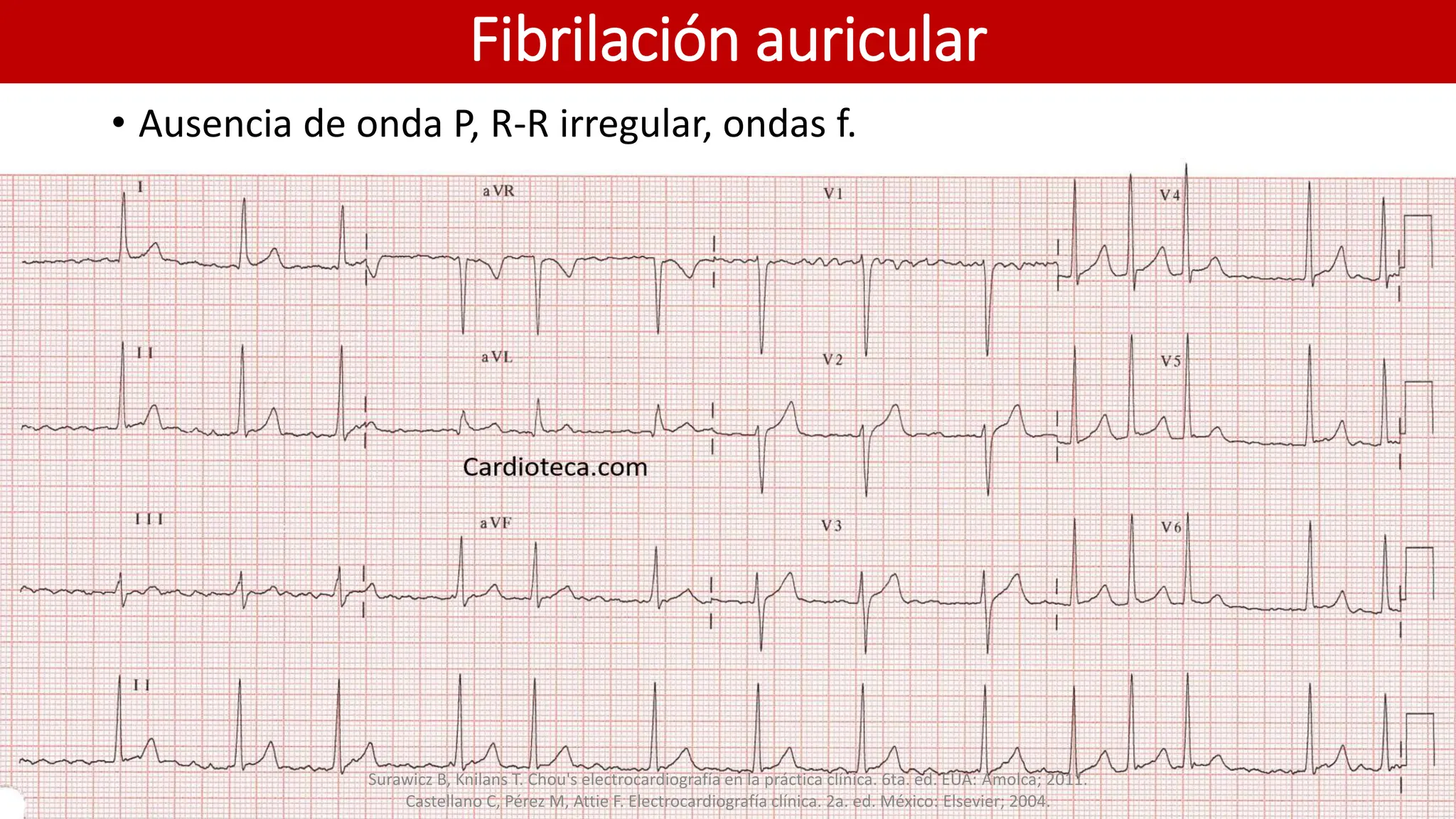 Electrocardiografía básica..........pptx