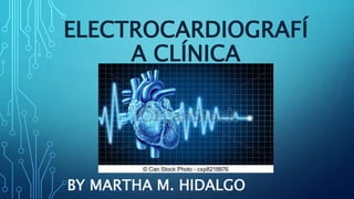 ELECTROCARDIOGRAFÍ
A CLÍNICA
BY MARTHA M. HIDALGO
 