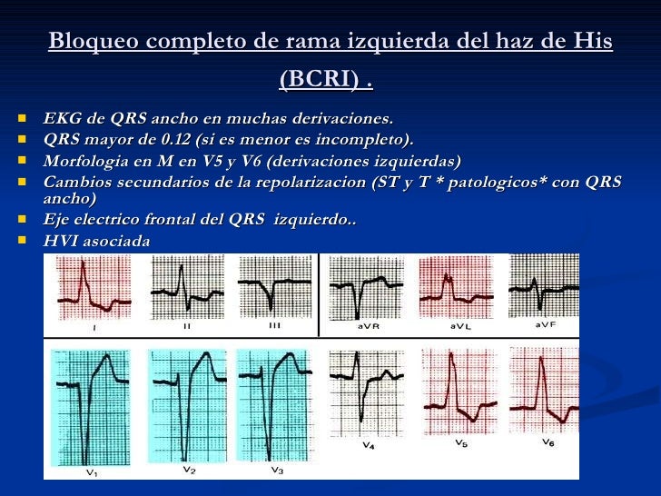 Electrocardiografia