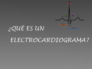 ¿QUÉ ES UN

ELECTROCARDIOGRAMA?
 