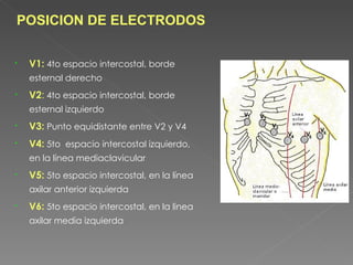 POSICION DE ELECTRODOS


   V1: 4to espacio intercostal, borde
    esternal derecho
   V2: 4to espacio intercostal, borde
    esternal izquierdo
   V3: Punto equidistante entre V2 y V4
   V4: 5to espacio intercostal izquierdo,
    en la línea mediaclavicular
   V5: 5to espacio intercostal, en la línea
    axilar anterior izquierda
   V6: 5to espacio intercostal, en la linea
    axilar media izquierda
 